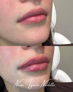 IMG_8527 2